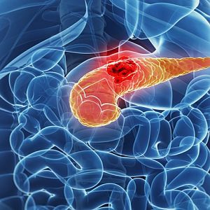 Cac-phuong-phap-dieu-tri-ung-thu-tuyen-tuy-hieu-qua2