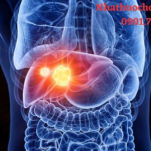 Ung thư gan: Nguyên nhân, biểu hiện và cách điều trị