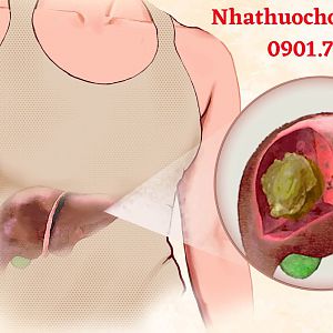 Phương pháp điều trị ung thư gan cho từng giai đoạn bệnh