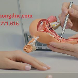 Phương pháp thư nội mạc tử cung và các thông tin quan trọng