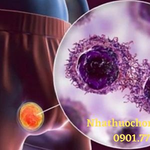 Ung thư tinh hoàn là gì? Những điều cần biết về ung thư tinh hoàn