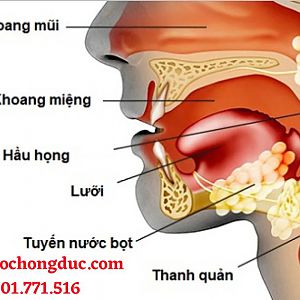Ung thư đầu cổ là gì? Gồm những loại nào? Có chữa được không?